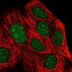 Invitrogen XRN2 Polyclonal Antibody 100 &mu;L; Unconjugated:Antibodies,