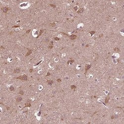 Invitrogen ZNF292 Polyclonal Antibody 100 &mu;L; Unconjugated:Antibodies,