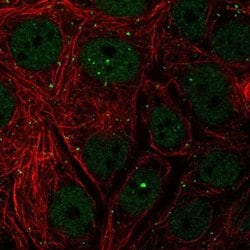 Invitrogen TH1L Polyclonal Antibody 100 &mu;L | Buy Online | Invitrogen&trade; | Fisher Scientific