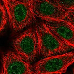 Invitrogen ZNF789 Polyclonal Antibody 100 &mu;L; Unconjugated:Antibodies,