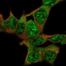AKAP17A Polyclonal Antibody:Antibodies, Polyclonal