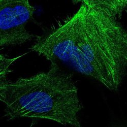 Invitrogen CTPS Polyclonal Antibody 100 &mu;L; Unconjugated:Antibodies,