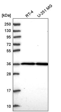 Invitrogen THAP5 Polyclonal Antibody 100 &mu;L; Unconjugated:Antibodies,
