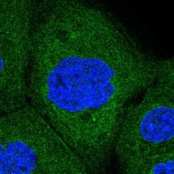 Invitrogen Ribophorin I Polyclonal Antibody 100 &mu;L; Unconjugated:Antibodies,