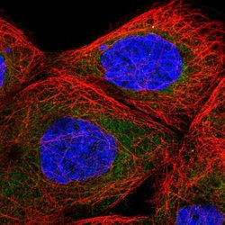 Invitrogen TBL2 Polyclonal Antibody 100 &mu;L; Unconjugated:Antibodies,