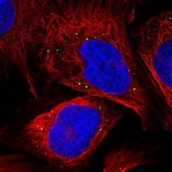 Invitrogen MAK10 Polyclonal Antibody 100 &mu;L; Unconjugated:Antibodies,