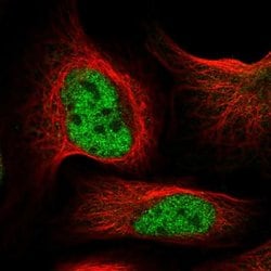 Invitrogen RC74 Polyclonal Antibody 100 &mu;L; Unconjugated:Antibodies,