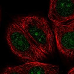 Invitrogen NOM1 Polyclonal Antibody 100 &mu;L; Unconjugated:Antibodies,