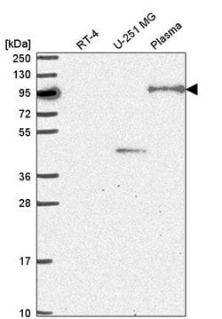 Invitrogen NOM1 Polyclonal Antibody 100 &mu;L; Unconjugated:Antibodies,