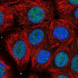 Invitrogen UBFD1 Polyclonal Antibody 100 &mu;L; Unconjugated:Antibodies,
