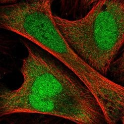 Invitrogen ANKRD36C Polyclonal Antibody 100 &mu;L; Unconjugated:Antibodies