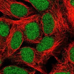 Invitrogen ALKBH2 Polyclonal Antibody 100 &mu;L; Unconjugated:Antibodies,