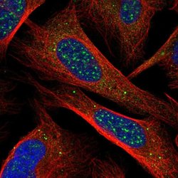 Invitrogen CHIC1 Polyclonal Antibody 100 &mu;L; Unconjugated:Antibodies,