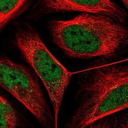 DSE Polyclonal Antibody:Antibodies, Polyclonal