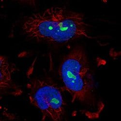 Invitrogen ZNF800 Polyclonal Antibody 100 &mu;L; Unconjugated:Antibodies,