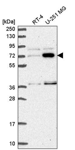 Invitrogen ZNF800 Polyclonal Antibody 100 &mu;L; Unconjugated:Antibodies,