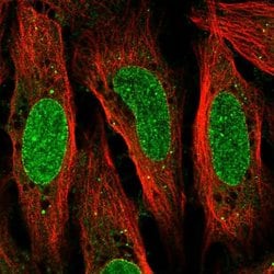 Invitrogen QRICH2 Polyclonal Antibody 100 &mu;L; Unconjugated:Antibodies,