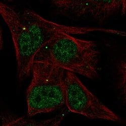 Invitrogen™ AKNA Polyclonal Antibody