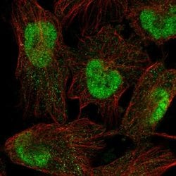 Invitrogen SPAG7 Polyclonal Antibody 100 &mu;L; Unconjugated:Antibodies,