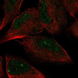 Invitrogen AMZ2 Polyclonal Antibody 100 &mu;L; Unconjugated:Antibodies,