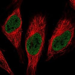 Invitrogen RNPC3 Polyclonal Antibody 100 &mu;L; Unconjugated:Antibodies,