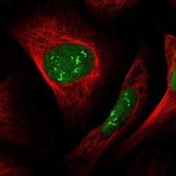 Invitrogen VPRBP Polyclonal Antibody 100 &mu;L; Unconjugated:Antibodies,