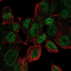 Invitrogen UBE2V1 Polyclonal Antibody 100 &mu;L; Unconjugated:Antibodies,