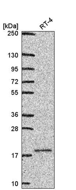 Invitrogen UBE2V1 Polyclonal Antibody 100 &mu;L; Unconjugated:Antibodies,