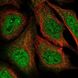 Invitrogen MAGEA11 Polyclonal Antibody 100 &mu;L; Unconjugated:Antibodies,