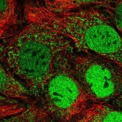 Invitrogen PCP4L1 Polyclonal Antibody 100 &mu;L; Unconjugated:Antibodies,