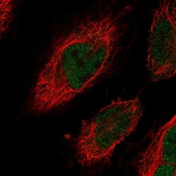 Invitrogen CENPN Polyclonal Antibody 100 &mu;L; Unconjugated:Antibodies,