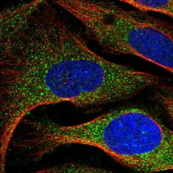 Invitrogen ARMC7 Polyclonal Antibody 100 &mu;L; Unconjugated:Antibodies,