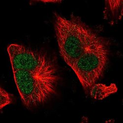 Invitrogen TSR1 Polyclonal Antibody 100 &mu;L; Unconjugated:Antibodies,