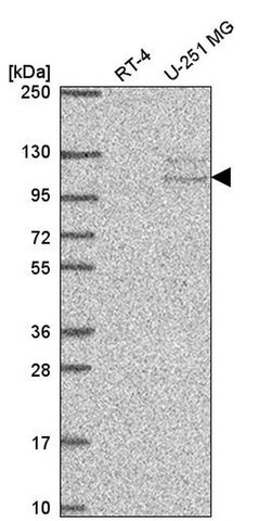 Invitrogen TSR1 Polyclonal Antibody 100 &mu;L; Unconjugated:Antibodies,
