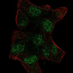 Invitrogen UBE2V1 Polyclonal Antibody 100 &mu;L; Unconjugated:Antibodies,