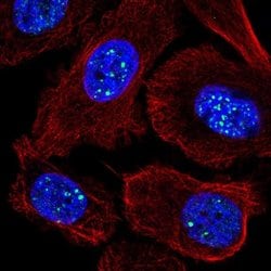 Invitrogen RASL11A Polyclonal Antibody 100 &mu;L; Unconjugated:Antibodies,