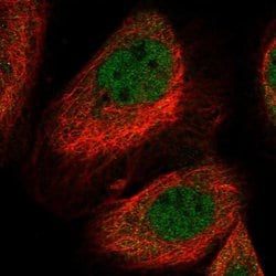 Invitrogen LYST Polyclonal Antibody 100 &mu;L; Unconjugated:Antibodies,