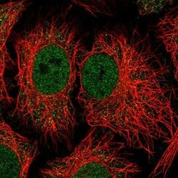 Invitrogen NADK Polyclonal Antibody 100 &mu;L; Unconjugated:Antibodies,
