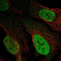 Invitrogen LAF4 Polyclonal Antibody 100 &mu;L; Unconjugated:Antibodies,