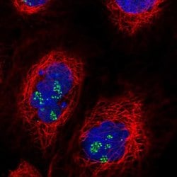 Invitrogen TRIM27 Polyclonal Antibody 100 &mu;L; Unconjugated:Antibodies,