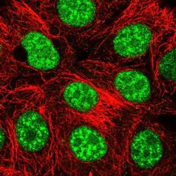 Invitrogen THAP4 Polyclonal Antibody 100 &mu;L; Unconjugated:Antibodies,