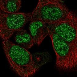 Invitrogen PAPLN Polyclonal Antibody 100 &mu;L; Unconjugated:Antibodies,