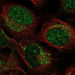 Invitrogen ZADH2 Polyclonal Antibody 100 &mu;L; Unconjugated:Antibodies,