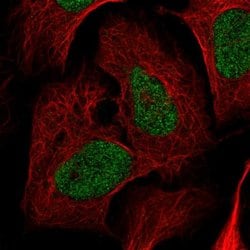 Invitrogen Nardilysin Polyclonal Antibody 100 &mu;L; Unconjugated:Antibodies,