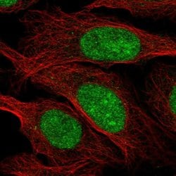 Invitrogen ZZZ3 Polyclonal Antibody 100 &mu;L; Unconjugated:Antibodies,