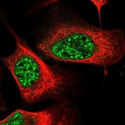 Invitrogen EEPD1 Polyclonal Antibody 100 &mu;L; Unconjugated:Antibodies,