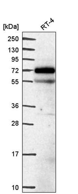 Invitrogen EEPD1 Polyclonal Antibody 100 &mu;L; Unconjugated:Antibodies,
