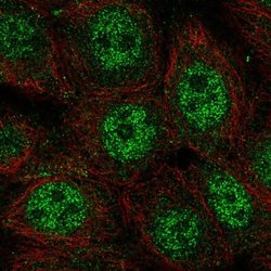 Invitrogen WDYHV1 Polyclonal Antibody 100 &mu;L; Unconjugated:Antibodies,