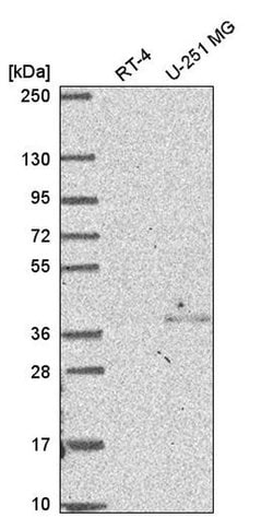 Invitrogen DC8 Polyclonal Antibody 100 &mu;L; Unconjugated:Antibodies,