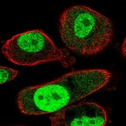 Invitrogen TMEM184A Polyclonal Antibody 100 &mu;L; Unconjugated:Antibodies,